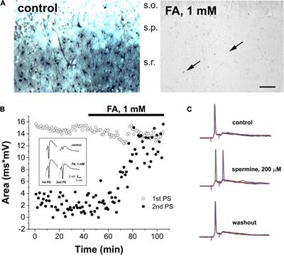 Critical Role of Astrocytic Polyamine and GABA Metabolism in Epileptogenesis